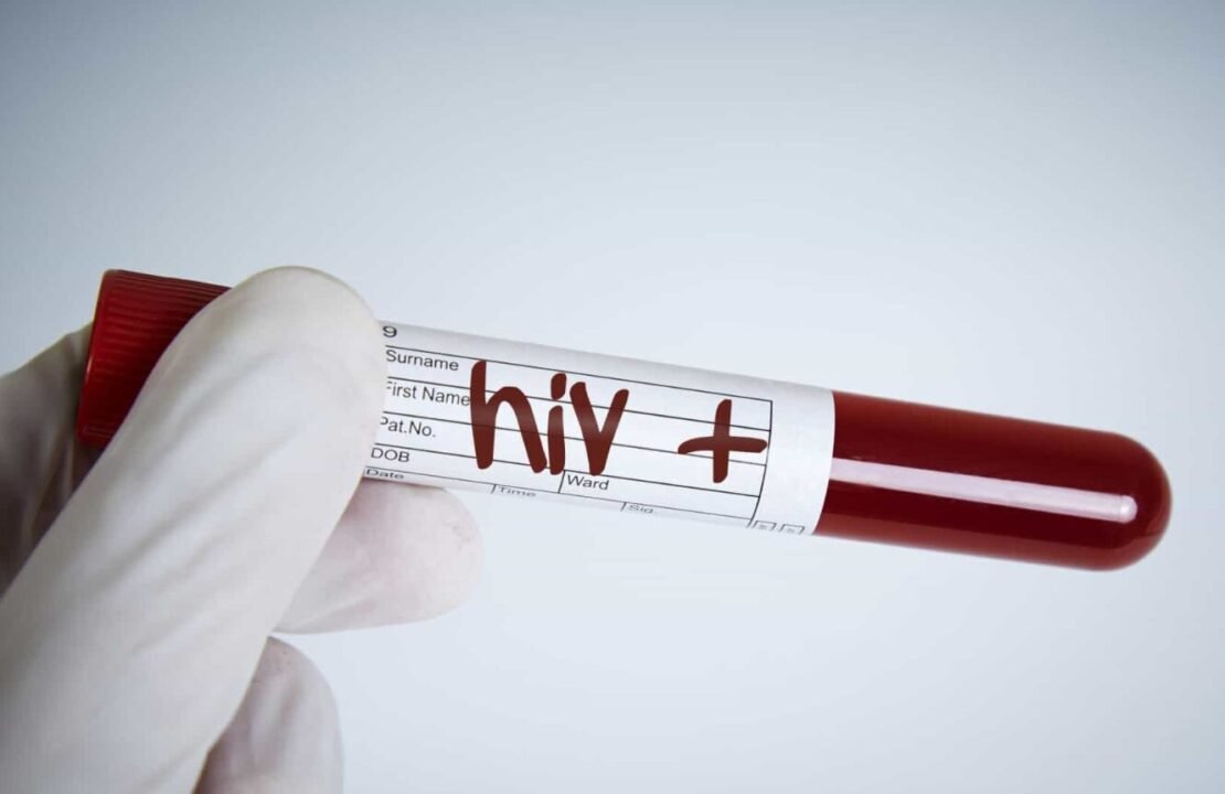 Gloved hand holding a blood sample tube labeled "HIV +".